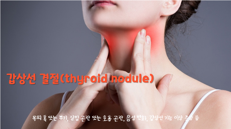 갑상선 결절(thyroid nodule)
갑상선 결절의 주요 증상 : 목의 혹 또는 부기, 삼킴 곤란 또는 호흡 곤란, 음성 변화, 갑상선 기능 이상 증상 등
