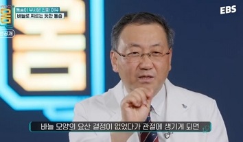 요산결정