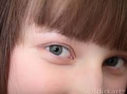 상안검 수술 비용