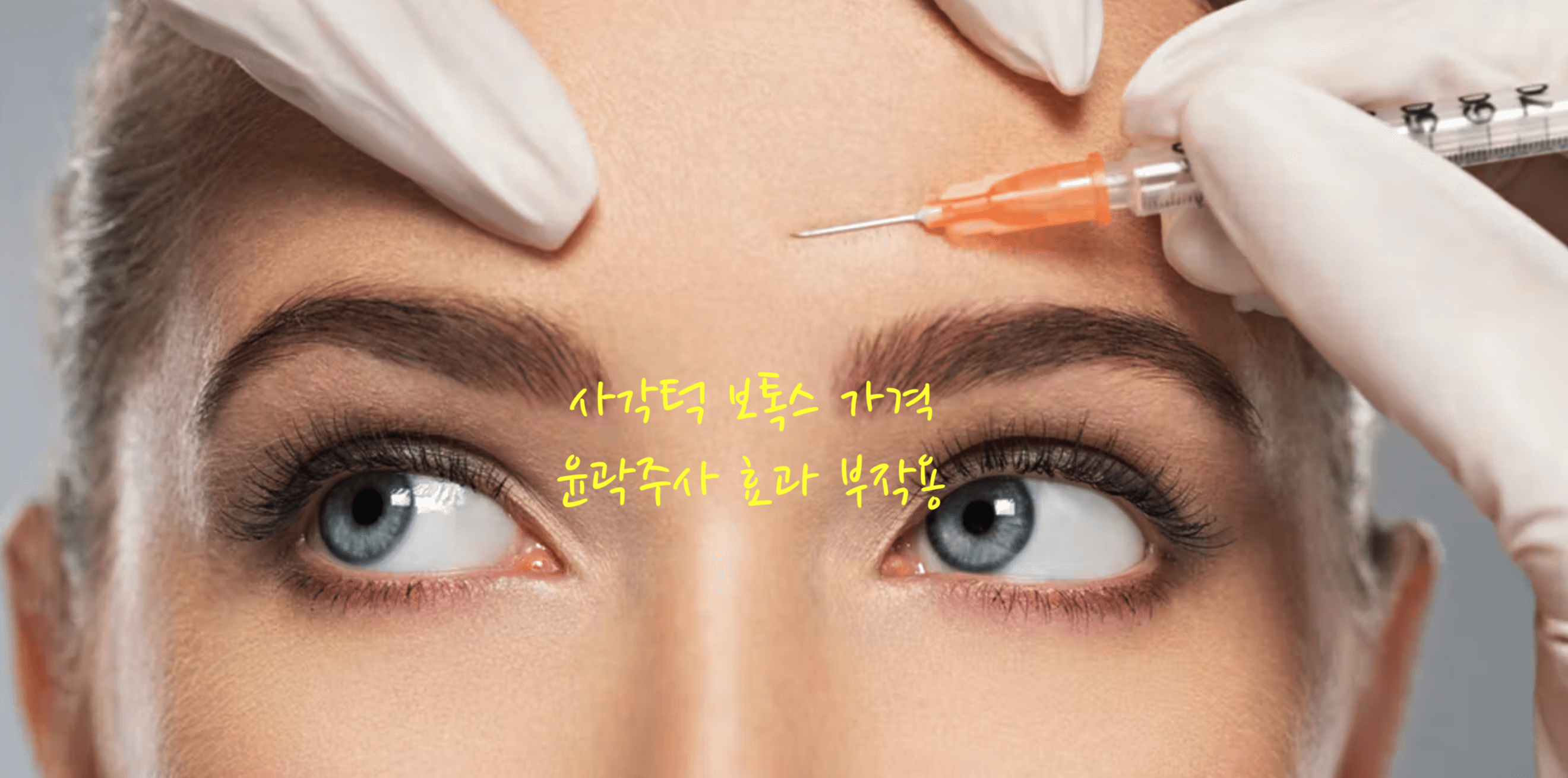 보톡스 가격