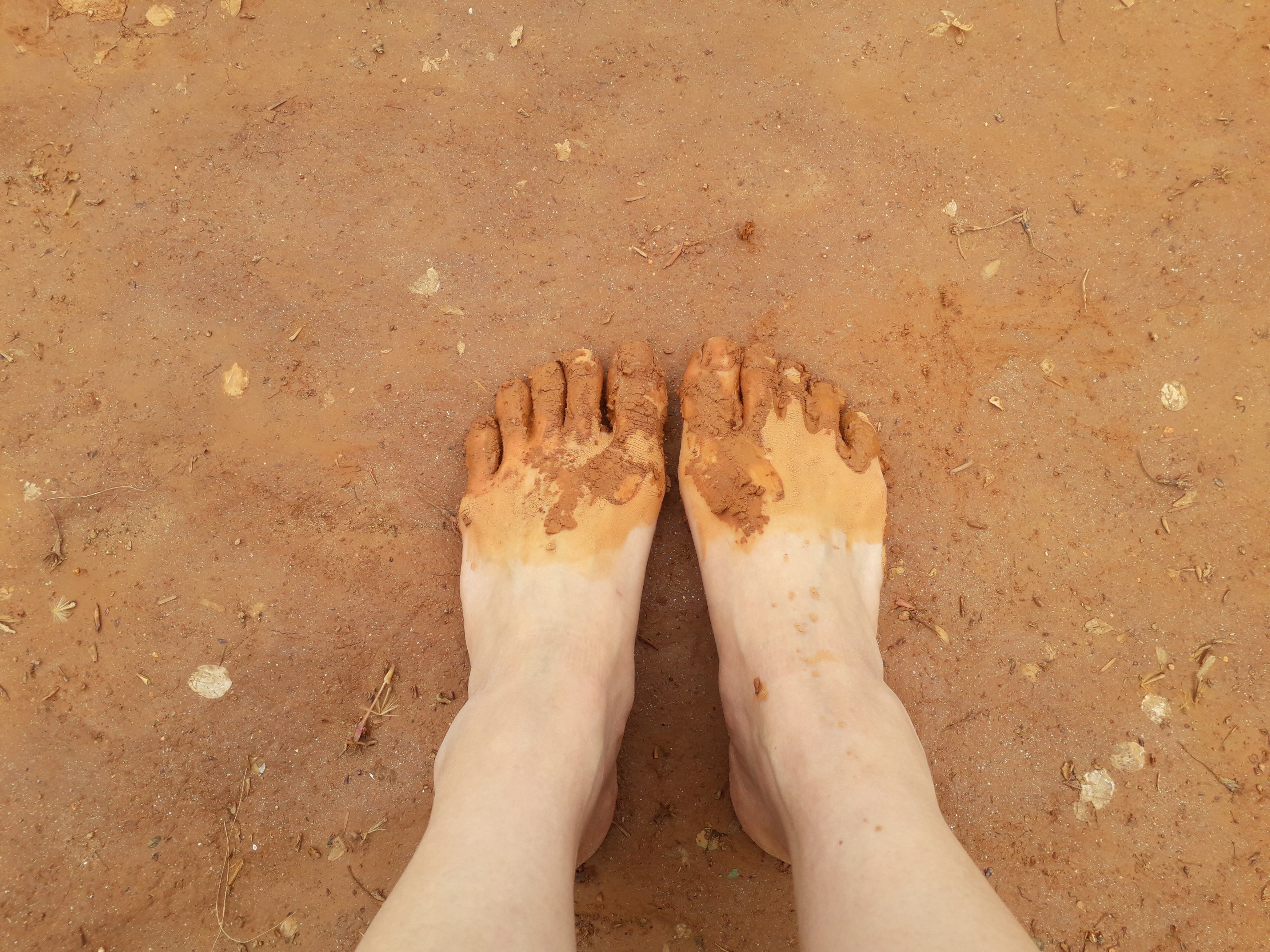 어싱(Earthing) 맨발걷기 효능