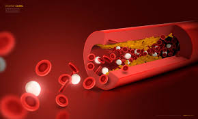 총콜레스테롤 정상수치