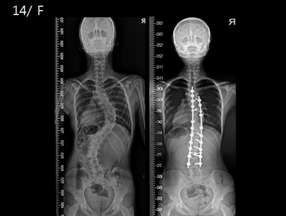 다리 꼬고 앉으면 이런 병들 생긴다...생각보다 심각...대책은?