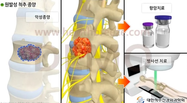 명의-김치헌교수