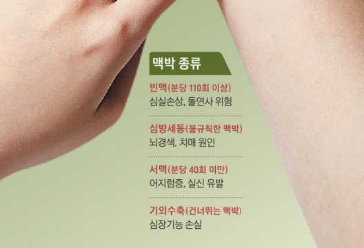 심장이 건너뛰는 느낌, 불규칙한 박동 등 다양한 부정맥의 종류를 설명하는 그래픽.