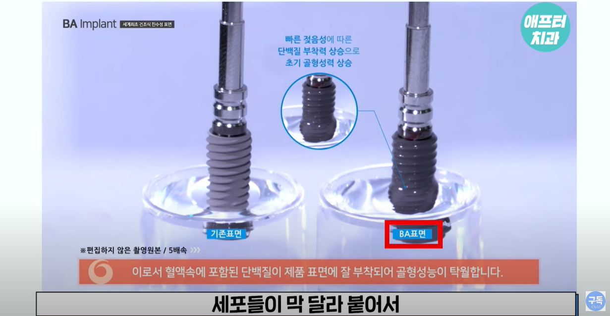 혈액과 결합하여 골유착 성공률을 높입니다.