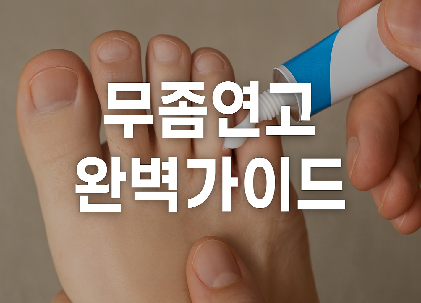 무좀연고 완벽가이드 썸네일 이미지