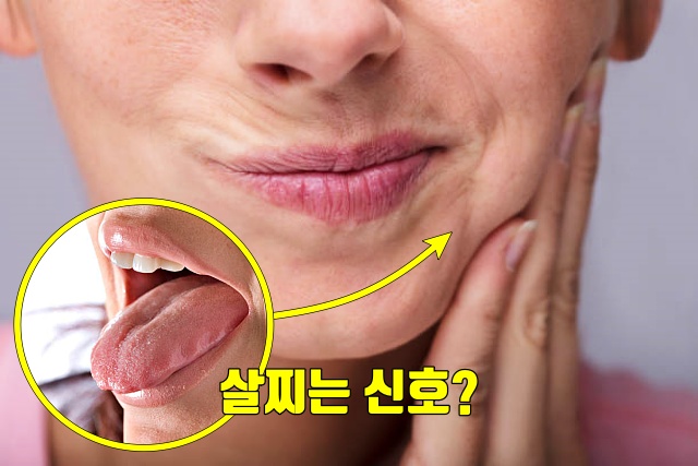 살찐 혀 깨물었을때 기도가 막히는 수면무호흡증, 내장지방 빼는법, 건강 팁줌 매일꿀정보