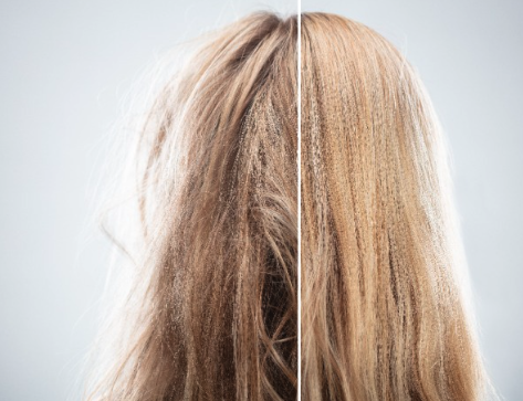 케라넷 효능 - 모발 윤기 개선