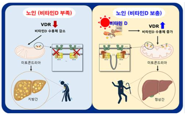 APOE ε4 유전자형과 인지기능 관련 이미지
