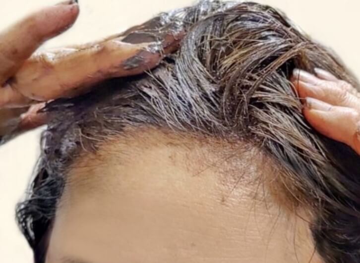 탈모 예방 혈자리