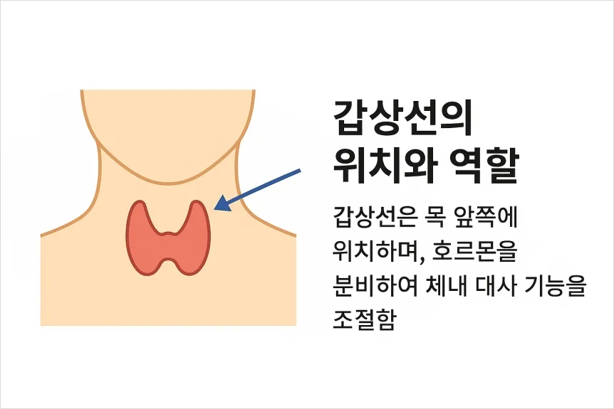 갑상선 기능 항진증