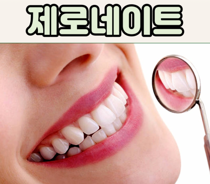 제로네이트 라미네이트 차이점