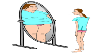 섭식장애 거식증 사진