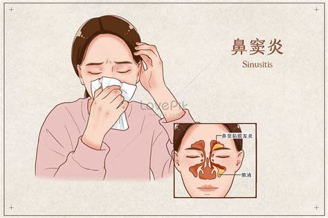 부비동염