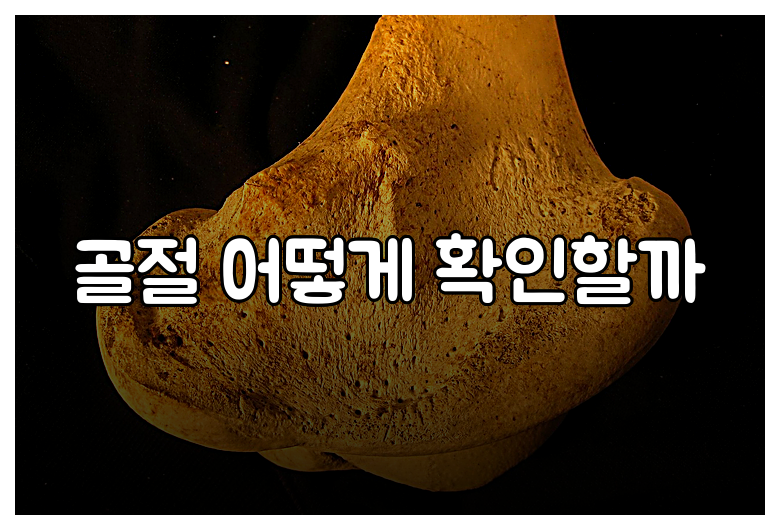 골절 어떻게 확인할까