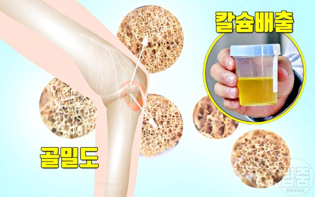커피 마시면 안되는 사람 커피 하루 권장량 폐경 골다공증