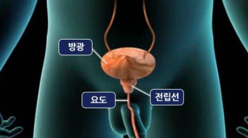 전립선_비대증증상