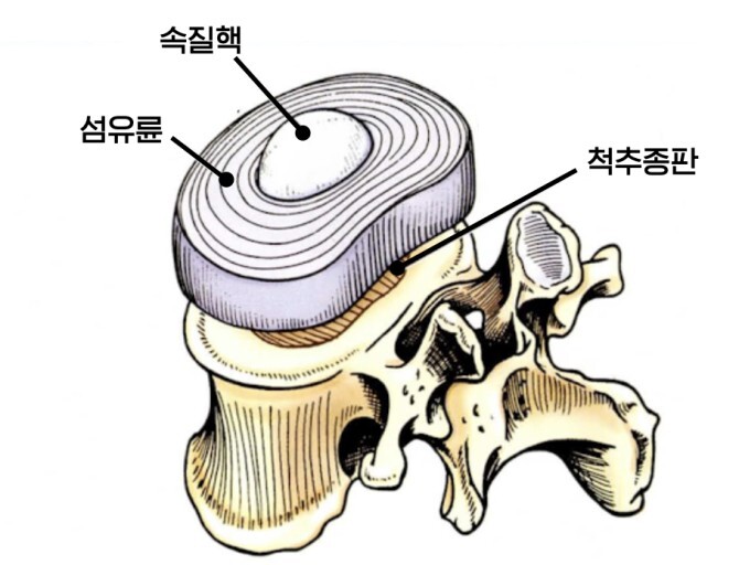 속질핵-척추원반-디스크