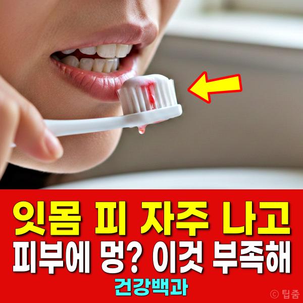 비타민c 부족 증상 잇몸 피