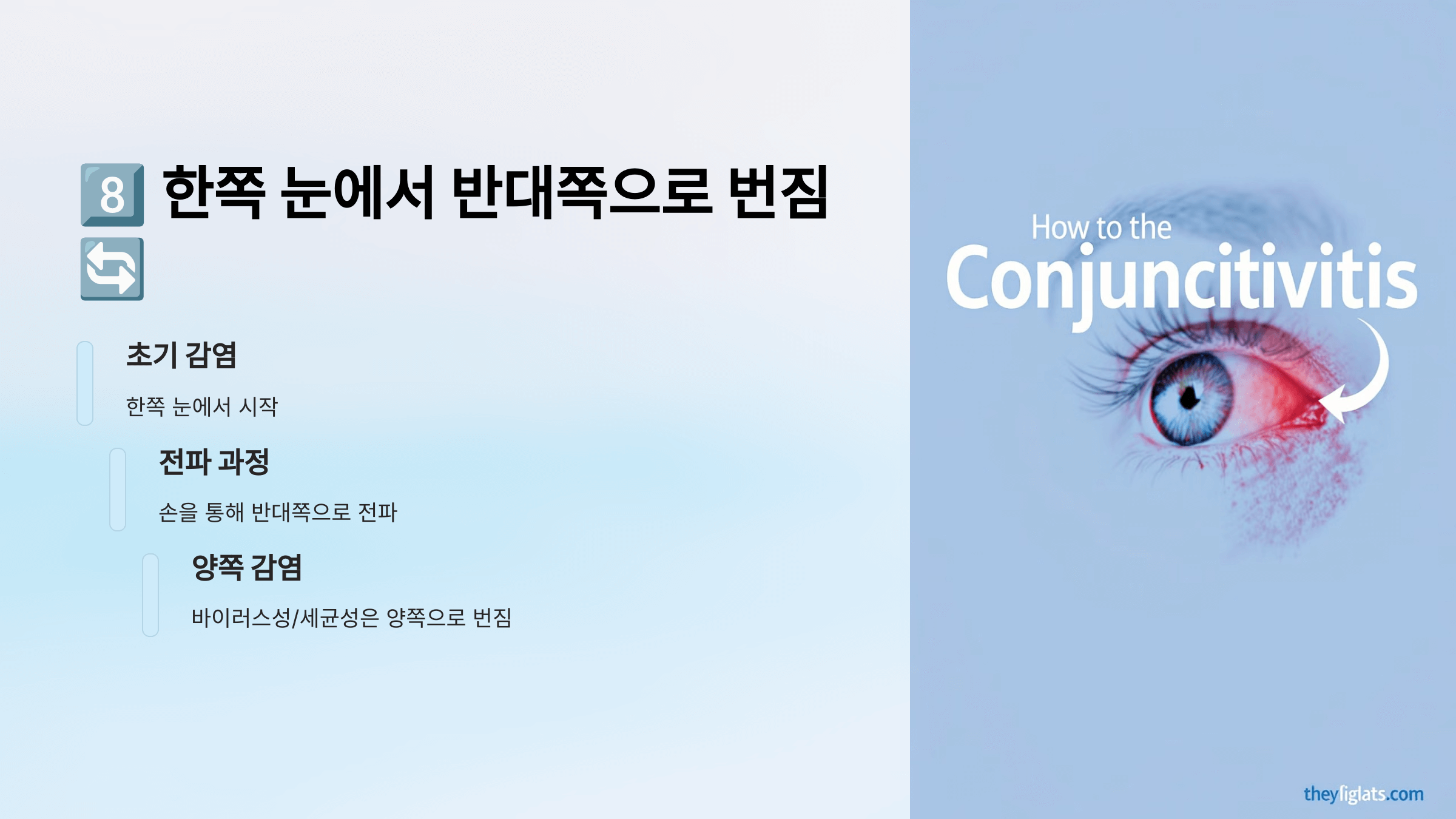 결막염과 관련된 사진입니다.