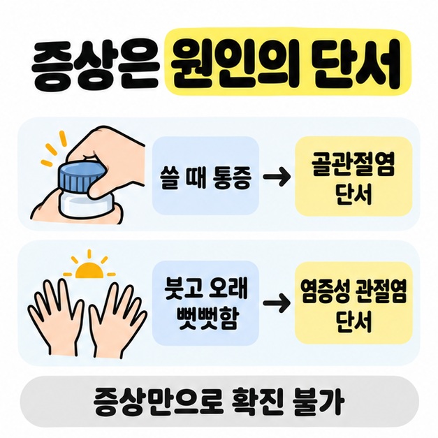 쓸 때 통증과 붓고 오래 뻣뻣한 증상을 각각 골관절염과 염증성 관절염의 단서로 비교하며 증상만으로 확진할 수 없음을 안내한 그림