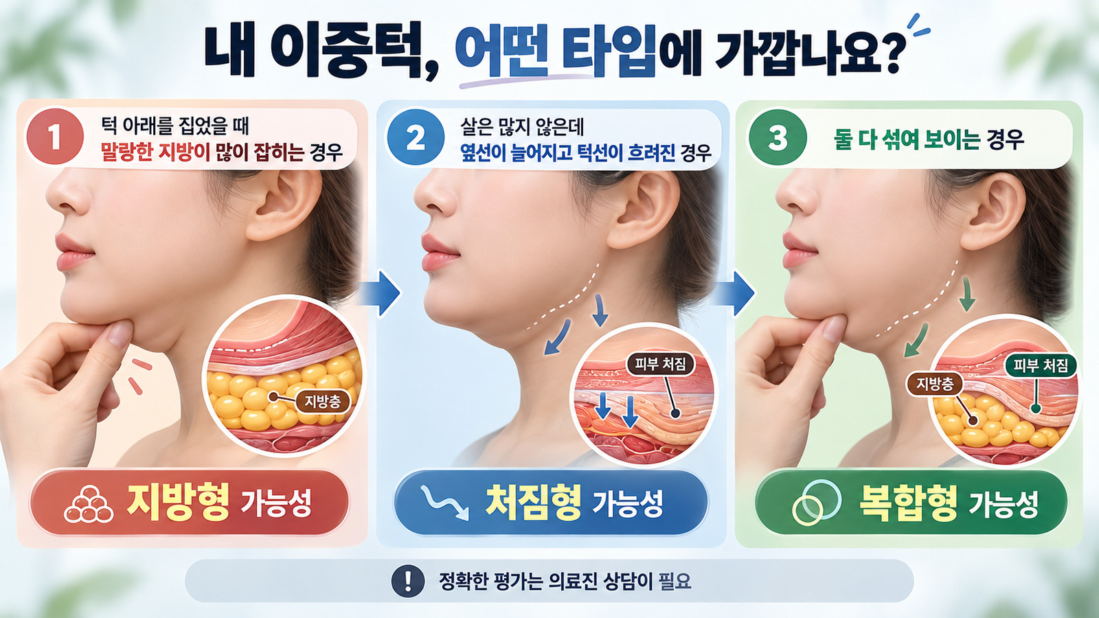 턱밑 지방형, 피부 처짐형, 두 문제가 섞인 복합형을 옆얼굴과 피부층 삽화로 비교하고 진료 필요성을 안내한 그림