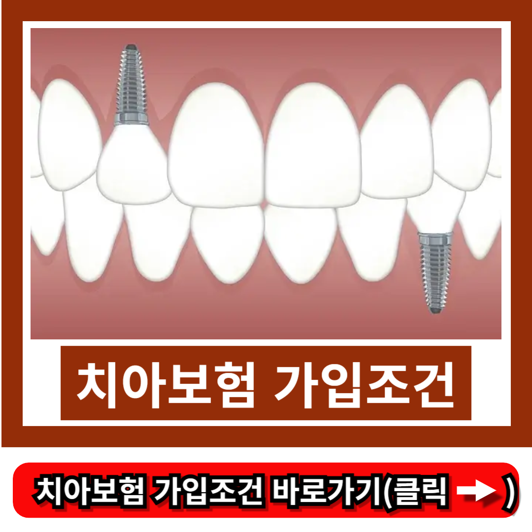 치아보험 가입조건