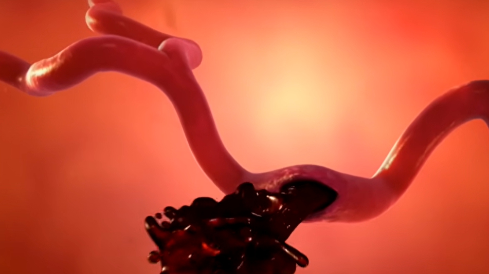 뇌경색 전조증상