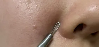 남자 얼굴 피지 제거 화장품 꿀템_11