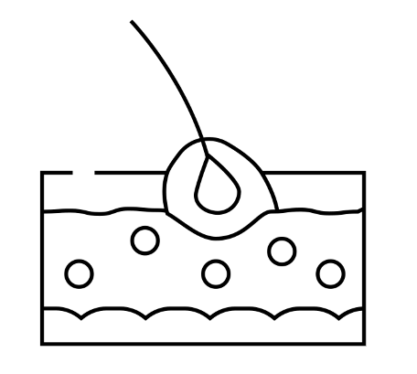 모낭염 원인과 치료방법
