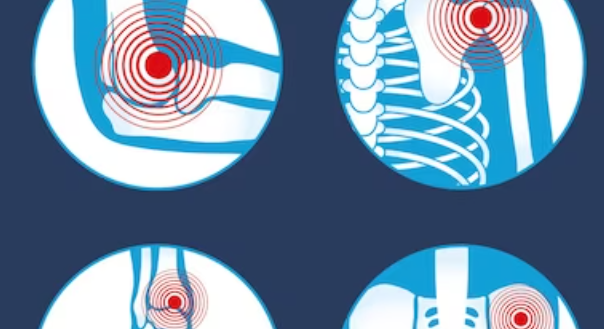 류마티스 관절염의 증상3