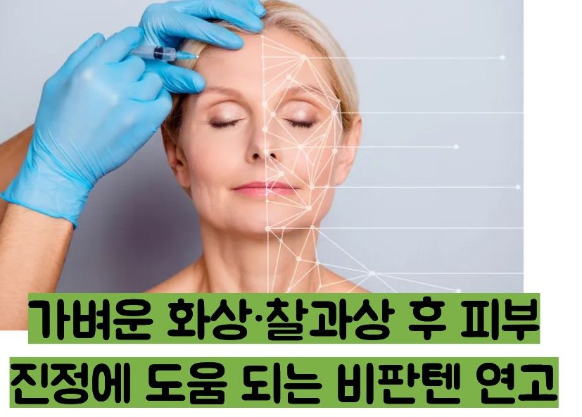 비판텐 연고 효능