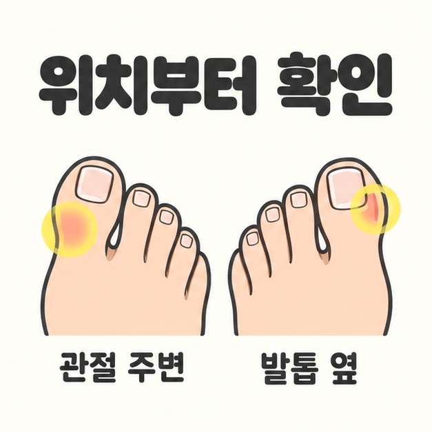 위치부터 확인 제목과 함께 관절 주변과 발톱 옆을 각각 표시한 두 발 삽화