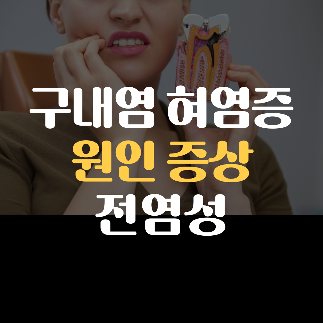 구내염 혀염증 원인 증상 전염성