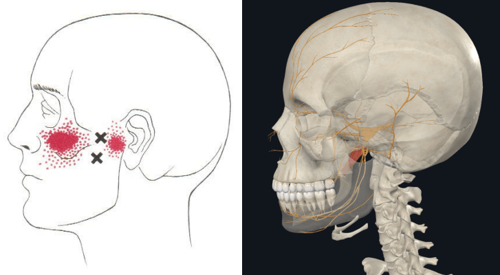 좌측은 외익돌근, 우측은 구개범장근