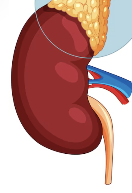 신장암 초기증상 4