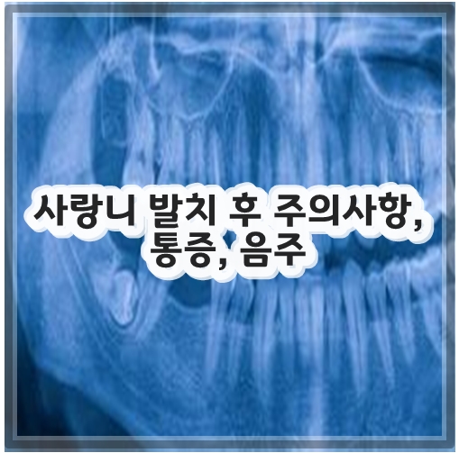 사랑니 발치 후 주의사항, 통증, 음주