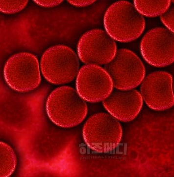 혈색소 수치가 높으면