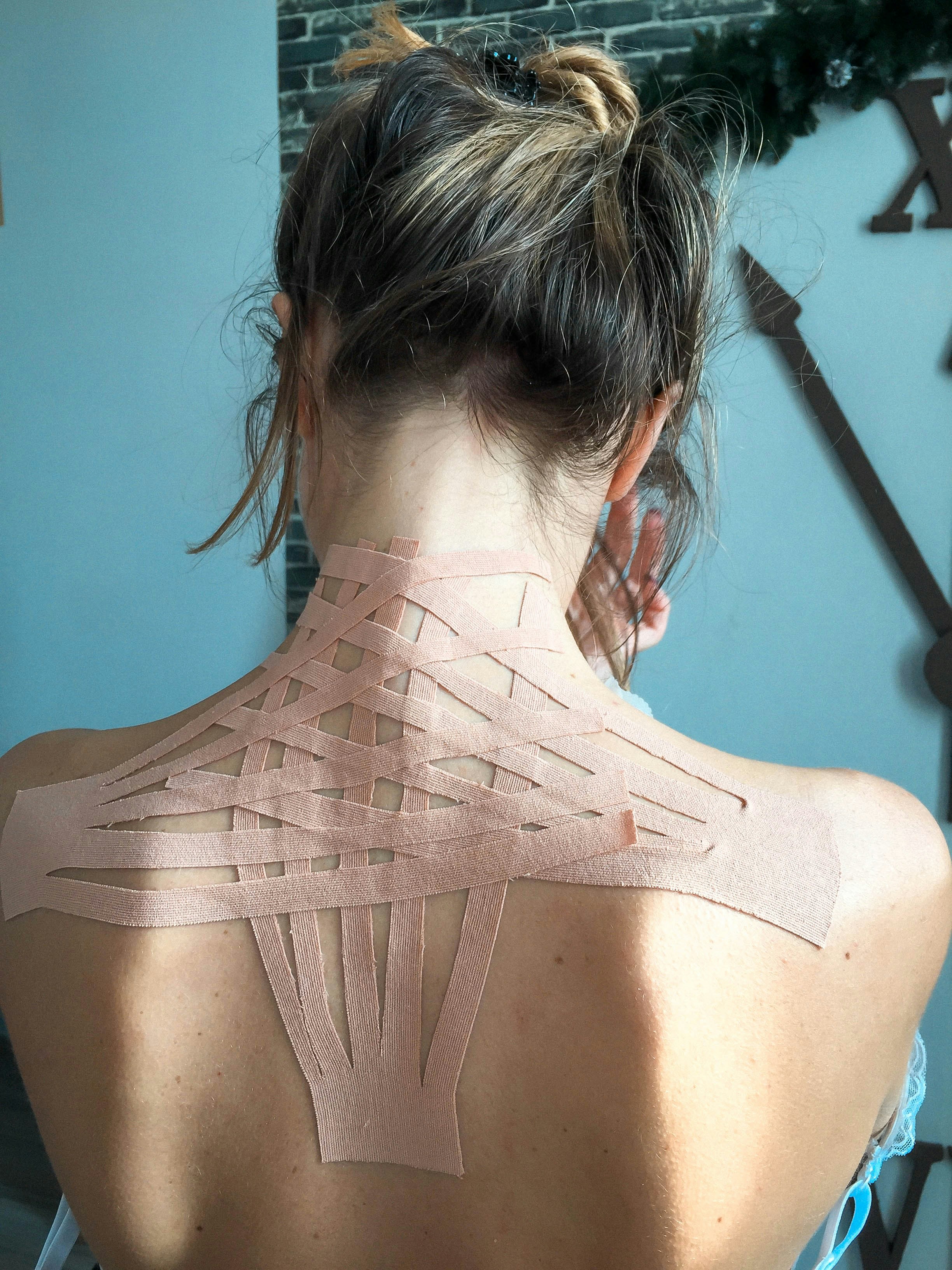 CRPS 복합부위 통증 증후군 치료 및 원인 (+ 1형 장애등급)