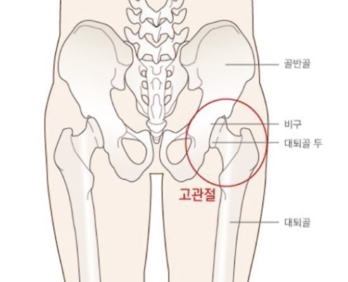 겨울철 관절염과 고관절 통증에 대한 사진