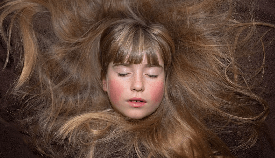 머리가 가려운 이유 - 8