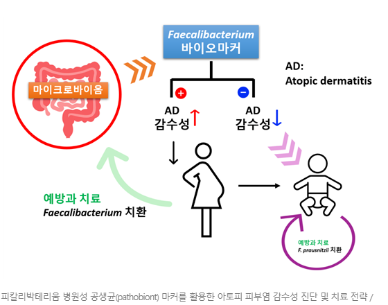 엄마 장내 세균과 식이섬유 부족의 아토피 피부염 원인 관련 이미지