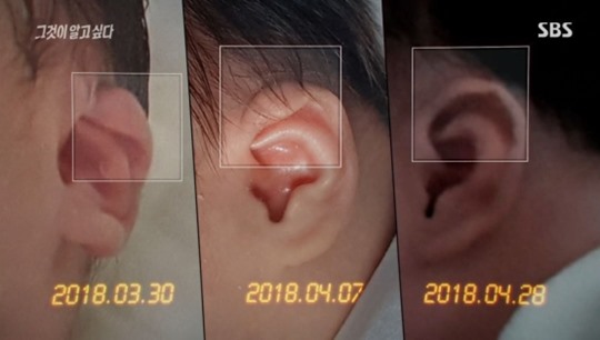 구미