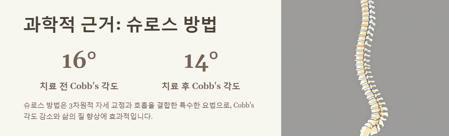 척추 측만증 교정운동