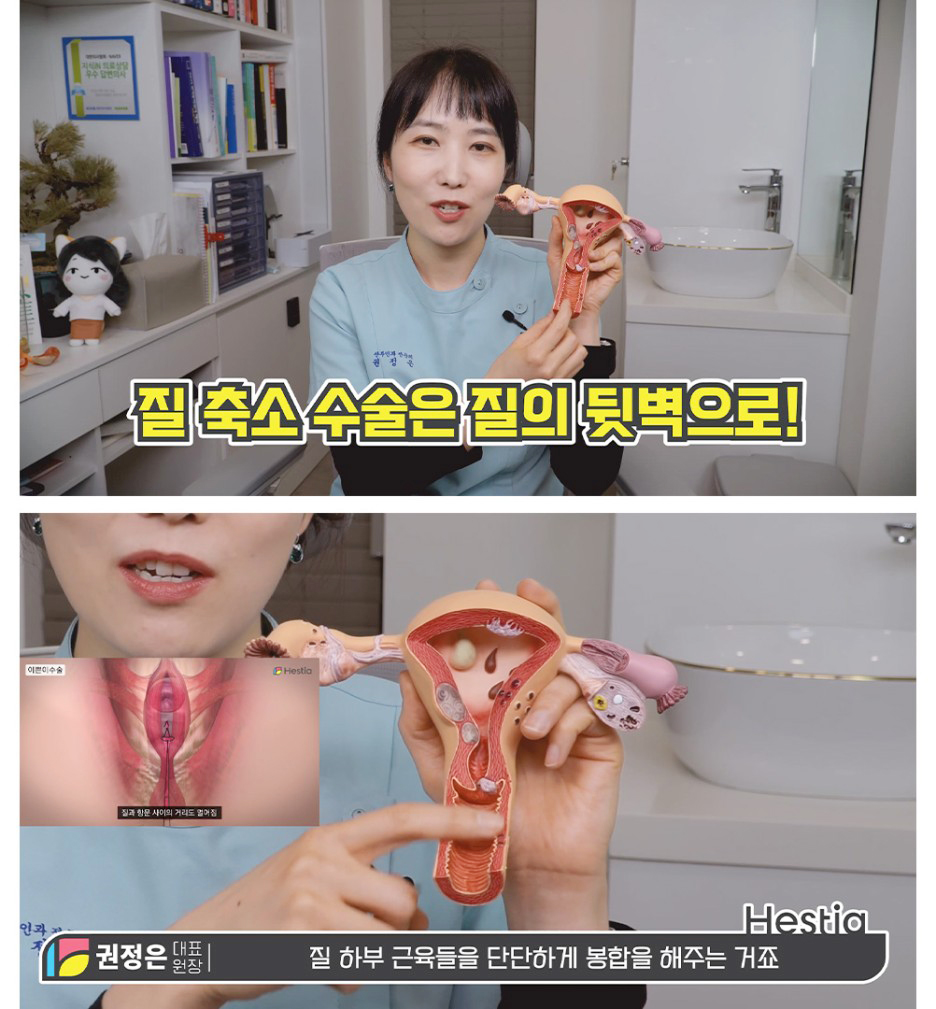 질축소수술은질의뒷벽으로
