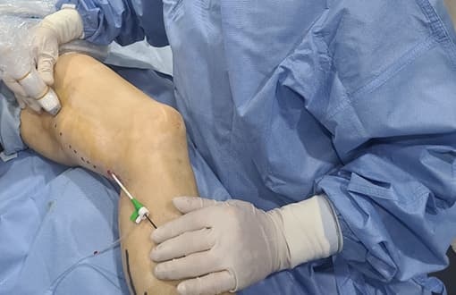 하지정맥류 증상