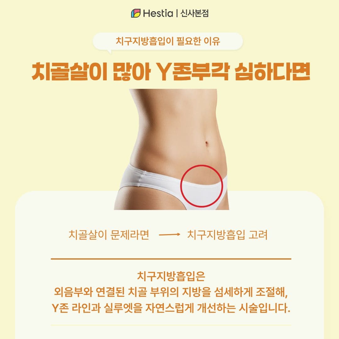 왜 Y존지방흡입은 산부인과인가?