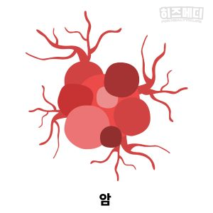 혈소판수치가 높으면