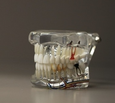 단면적인 치아근관을 볼 수있는 치아모형